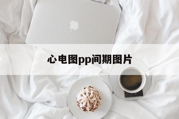 心电图pp间期图片(心电图pp间期怎么算心率)